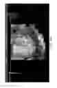 Fig. 22 - Ultrasonographic images processing