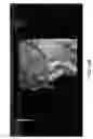 Fig. 23 - Ultrasonographic images processing