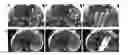 Fig. 01 - Method for the detection and staging of liver fibrosis from image acquired data