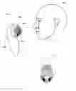 Fig. 01 - Devices and methods for profiling microbiota of skin