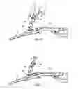 Fig. 11 - SYSTEMS AND METHODS FOR TREATING TISSUE REGIONS OF THE BODY