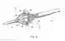 Fig. 15 - SYSTEMS AND METHODS FOR TREATING TISSUE REGIONS OF THE BODY