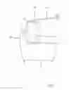 Fig. 02 - DEVICE FOR STIMULATING CAPILLARY CONDITIONING