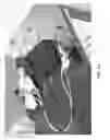 Fig. 02 - ISOLATED ORTHOSIS FOR THUMB ACTUATION
