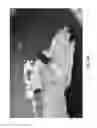 Fig. 06 - ISOLATED ORTHOSIS FOR THUMB ACTUATION