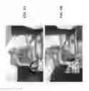 Fig. 09 - ISOLATED ORTHOSIS FOR THUMB ACTUATION