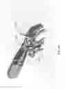 Fig. 15 - ISOLATED ORTHOSIS FOR THUMB ACTUATION