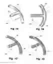 Fig. 02 - Shunt device and method for treating ocular disorders