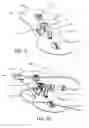 Fig. 09 - Catheter adapter assembly and system