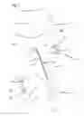Fig. 02 - Composite Cannula