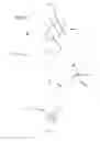 Fig. 08 - Composite Cannula
