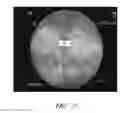 Fig. 04 - Apparatuses and methods for wound therapy