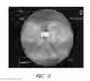 Fig. 06 - Apparatuses and methods for wound therapy