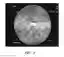 Fig. 07 - Apparatuses and methods for wound therapy
