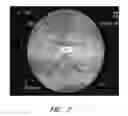Fig. 08 - Apparatuses and methods for wound therapy