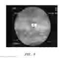 Fig. 09 - Apparatuses and methods for wound therapy