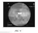Fig. 10 - Apparatuses and methods for wound therapy