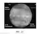 Fig. 12 - Apparatuses and methods for wound therapy