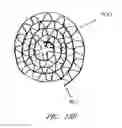Fig. 17 - Apparatuses and methods for wound therapy