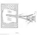 Fig. 05 - Systems and methods for performing an injection