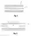 Fig. 02 - MEDICAL BALLOON WITH A PRECISELY IDENTIFIABLE PORTION