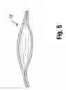 Fig. 05 - MEDICAL BALLOON WITH A PRECISELY IDENTIFIABLE PORTION