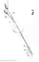 Fig. 07 - MEDICAL BALLOON WITH A PRECISELY IDENTIFIABLE PORTION