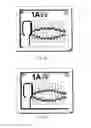 Fig. 34 - SYSTEMS, APPARATUS, METHODS, AND PROCEDURES FOR THE NON-INVASIVE TREATMENT OF TISSUE USING MICROWAVE ENERGY