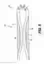 Fig. 06 - INSULATED ABLATION CATHETER DEVICES AND METHODS OF USE