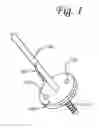 Fig. 02 - Apparatus and method for performing intrastromalabdominal hysterectomy as bloodless nerve sparing method
