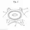 Fig. 03 - Apparatus and method for performing intrastromalabdominal hysterectomy as bloodless nerve sparing method