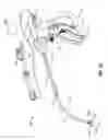 Fig. 02 - Articulating surgical apparatus