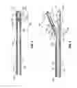 Fig. 04 - Surgical forceps