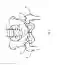 Fig. 02 - Method for femur resection alignment approximation in hip replacement procedures