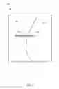 Fig. 07 - Method for femur resection alignment approximation in hip replacement procedures