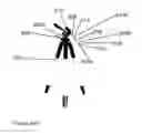 Fig. 27 - Uterine manipulator
