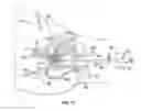 Fig. 28 - Uterine manipulator