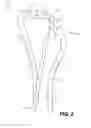 Fig. 03 - Medical retrieval devices and related methods of use