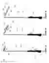 Fig. 05 - Delivery system assemblies and associated methods for implantable medical devices