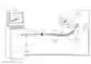 Fig. 01 - Robotic assister for catheter insertion