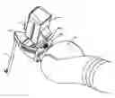 Fig. 01 - Robotic surgery system