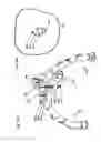 Fig. 12 - Robotic surgery system