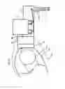 Fig. 19 - Robotic surgery system