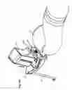 Fig. 22 - Robotic surgery system