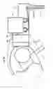Fig. 12 - Surgical robot system