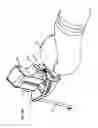 Fig. 15 - Surgical robot system