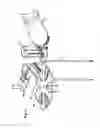 Fig. 16 - Surgical robot system