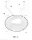 Fig. 08 - Removable deployment device, system, and method for implantable prostheses