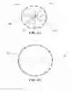 Fig. 10 - Removable deployment device, system, and method for implantable prostheses