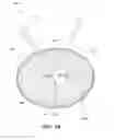 Fig. 12 - Removable deployment device, system, and method for implantable prostheses